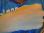 Demon Or Violent Ghost Scratches My Hand